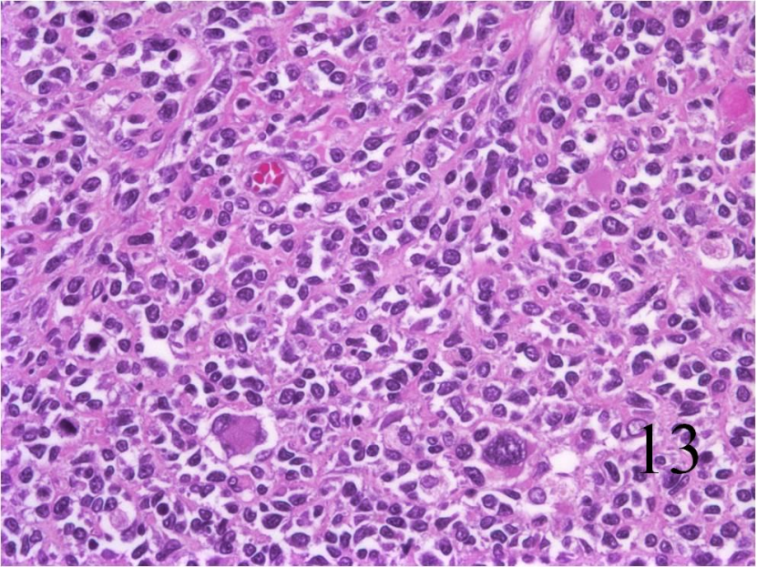 How Methyl-β-Cyclodextrin Inhibits Proliferation, Migration, and Invasion of Rhabdomyosarcoma Cells